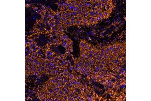 Immunofluorescence (IF) image for anti-CD44 (CD44) (AA 700-742) antibody (ABIN7454002) (Recombinant CD44 anticorps  (AA 700-742))