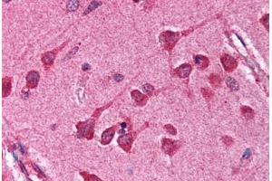 Human Brain, Cortex (formalin-fixed, paraffin-embedded) stained with NFKBIA antibody ABIN218609 at 1:1000 followed by biotinylated goat anti-rabbit IgG secondary antibody ABIN481713, alkaline phosphatase-streptavidin and chromogen. (NFKBIA anticorps  (C-Term))