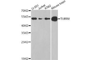 Western blot analysis of extracts of various cell lines, using TUBB8 antibody (ABIN5974843) at 1/1000 dilution. (Tubulin, beta 8 anticorps)