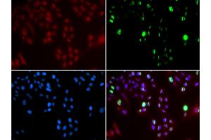 Immunofluorescence analysis of GFP-RNF168 transgenic U2OS cells using FANCD2 antibody (ABIN5971101). (FANCD2 anticorps)