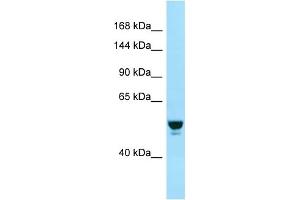 Western Blotting (WB) image for anti-RAB GTPase Activating Protein 1 (RABGAP1) (N-Term) antibody (ABIN2499655) (RABGAP1 anticorps  (N-Term))