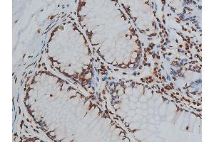 ABIN6267568 at 1/200 staining human colon tissue sections by IHC-P.