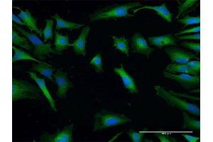 Immunofluorescence of purified MaxPab antibody to SH3GLB2 on HeLa cell. (SH3GLB2 anticorps  (AA 1-395))