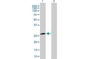 Western Blot analysis of LGALS3 expression in transfected 293T cell line by LGALS3 MaxPab polyclonal antibody. (Galectin 3 anticorps  (AA 1-250))