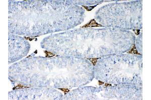 IHC analysis of NSF using anti-NSF antibody .