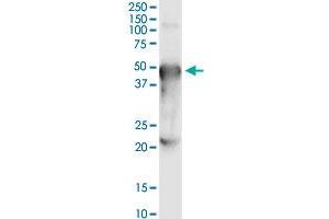 Immunoprecipitation of PORCN transfected lysate using anti-PORCN MaxPab rabbit polyclonal antibody and Protein A Magnetic Bead , and immunoblotted with .