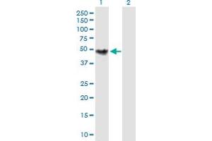 Western Blot analysis of CHKB expression in transfected 293T cell line by CHKB MaxPab polyclonal antibody. (CHKB anticorps  (AA 1-395))