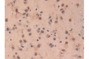 Detection of GFAP in Mouse Brain Tissue using Polyclonal Antibody to Glial Fibrillary Acidic Protein (GFAP)