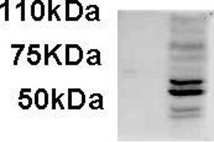 AP22454PU-N AIM2 antibody staining of IFNbeta-treated WI-38 lysate (35µg protein in RIPA buffer). (AIM2 anticorps  (C-Term))