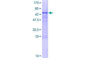 Image no. 1 for Tolloid-Like 1 (TLL1) (AA 1-392) protein (GST tag) (ABIN1322847)