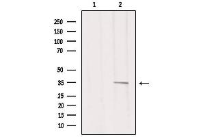 Western blot analysis of extracts from 293, using MSHR Antibody. (MC1 Receptor anticorps  (C-Term))