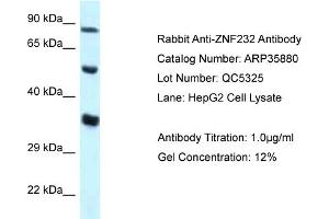 WB Suggested Anti-ZNF232 Antibody   Titration: 1. (ZNF232 anticorps  (N-Term))