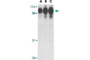 Western blot analysis of ACE2 in human kidney tissue lysate with ACE2 polyclonal antibody  at (A) 0. (ACE2 anticorps  (Internal Region))