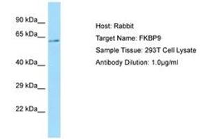 Image no. 1 for anti-FK506 Binding Protein 9, 63 KDa (FKBP9) (C-Term) antibody (ABIN6750098) (FKBP9 anticorps  (C-Term))
