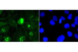 Immunofluorescence analysis of A431 cells using MKI67 antibody (ABIN5997055). (Ki-67 anticorps)