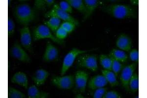 Detection of LEI in Human Hela Cell using Polyclonal Antibody to Leukocyte Elastase Inhibitor (LEI)