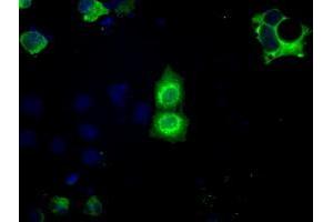 Image no. 5 for anti-Basigin (Ok Blood Group) (BSG) antibody (ABIN1498015) (CD147 anticorps)