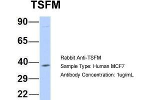 Host: Rabbit Target Name: TSFM Sample Type: Human MCF7 Antibody Dilution: 1.