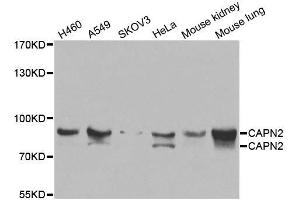 Western blot analysis of extracts of various cell lines, using CAPN2 antibody. (Calpain 2 anticorps  (AA 350-680))