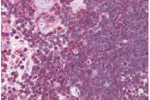 Human Thymus (formalin-fixed, paraffin-embedded) stained with ALOX5 antibody ABIN214074 at 10 ug/ml followed by biotinylated goat anti-rabbit IgG secondary antibody ABIN481713, alkaline phosphatase-streptavidin and chromogen.