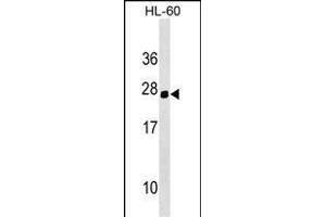 Mouse Hoxc5 Antibody (C-term) (ABIN1536714 and ABIN2849346) western blot analysis in HL-60 cell line lysates (35 μg/lane). (Homeobox C5 anticorps  (C-Term))