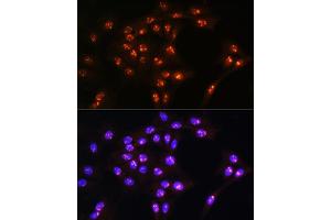 Immunofluorescence analysis of C6 cells using LYAR Rabbit pAb  at dilution of 1:100.