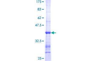 Image no. 1 for Sema Domain, Immunoglobulin Domain (Ig), Short Basic Domain, Secreted, (Semaphorin) 3C (SEMA3C) (AA 653-751) protein (GST tag) (ABIN1319463)