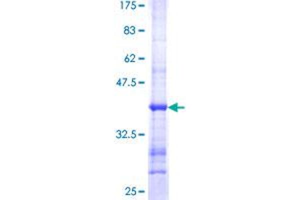 SEMA3C Protein (AA 653-751) (GST tag)