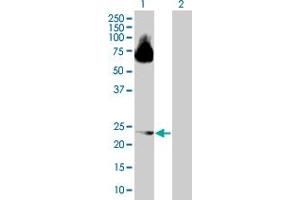 Western Blot analysis of ARL4D expression in transfected 293T cell line by ARL4D MaxPab polyclonal antibody. (ARL4D anticorps  (AA 1-201))