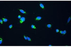 IF analysis of FH using anti-FH antibody (ABIN5518986).