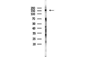 Western blot analysis of lysates from Rat brain, using Phospho-PDGF Receptor beta (Tyr771) Antibody at 1/1000 dilution.