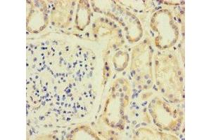 Immunohistochemistry of paraffin-embedded human kidney tissue using ABIN7170610 at dilution of 1:100 (SPIN4 anticorps  (AA 1-249))