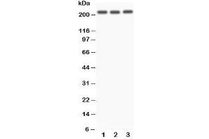 Western blot testing of NOTCH4 antibody and Lane 1:  A549;  2: SMMC-7721;  3: HeLa. (NOTCH4 anticorps  (C-Term))