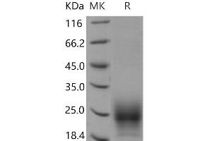 Western Blotting (WB) image for T Cell Immunoreceptor with Ig and ITIM Domains (TIGIT) (Active) protein (His tag) (ABIN7320104)