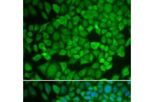 Immunofluorescence analysis of U2OS cells using NR0B1 Polyclonal Antibody (NR0B1 anticorps)