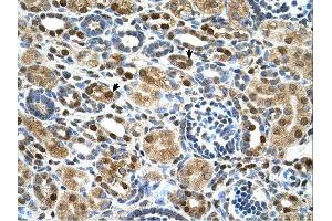 ZNF169 antibody was used for immunohistochemistry at a concentration of 4-8 ug/ml. (ZNF169 anticorps  (Middle Region))