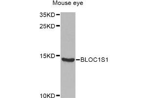 Western blot analysis of extracts of mouse eye, using BLOC1S1 Antibody (ABIN2561427) at 1:1000 dilution.