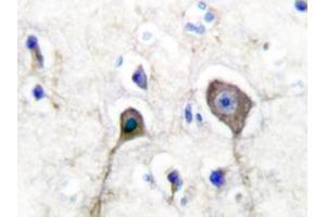 Image no. 1 for anti-S100 Calcium Binding Protein A1 (S100A1) antibody (ABIN271809) (S100A1 anticorps)