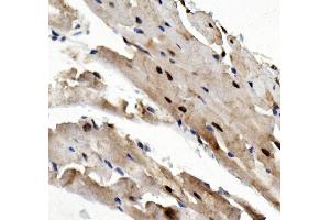 IHC analysis of Rad9/Rad9a using anti-Rad9/Rad9a antibody (ABIN7599342). (RAD9A anticorps  (AA 1-389))