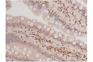ABIN6269133 at 1/200 staining Rat intestinal tissue sections by IHC-P. (KIT anticorps  (Internal Region))