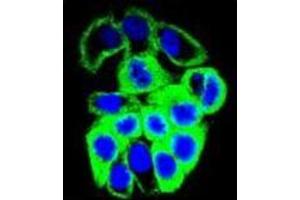 Confocal immunofluorescent analysis of GALNS Antibody (Center) Cat.