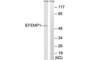 Western blot analysis of extracts from rat lung, using EFEMP1 Antibody. (FBLN3 anticorps  (AA 111-160))