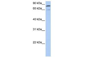 WB Suggested Anti-MFN2 Antibody Titration:  0. (MFN2 anticorps  (C-Term))