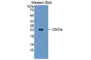 Detection of Recombinant TNFRSF5, Mouse using Polyclonal Antibody to Tumor Necrosis Factor Receptor Superfamily, Member 5 (CD40)