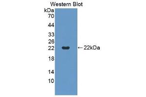 Detection of Recombinant TNFRSF5, Mouse using Polyclonal Antibody to Tumor Necrosis Factor Receptor Superfamily, Member 5 (CD40) (CD40 anticorps  (AA 26-193))