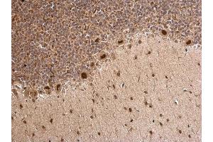 IHC-P Image MTA1 antibody [C1C3] detects MTA1 protein at nucleus on rat hind brain by immunohistochemical analysis.