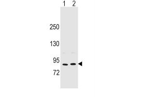 Western Blotting (WB) image for anti-Periostin (POSTN) antibody (ABIN2996464)
