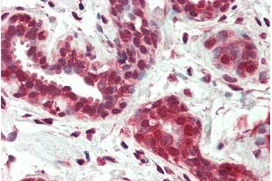 ABIN334451 (5µg/ml) staining of paraffin embedded Human Breast. (NR4A1 anticorps  (Internal Region))
