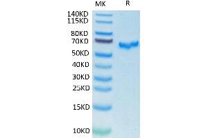 SARS-COV-2 Spike RBD on Tris-Bis PAGE under reduced condition. (SARS-CoV-2 Spike Protein (RBD) (mFc Tag))