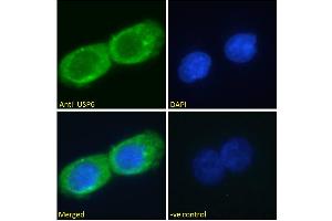 ABIN1019674 Immunofluorescence analysis of paraformaldehyde fixed A431 cells, permeabilized with 0. (USP6 anticorps  (AA 142-155))
